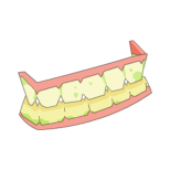 Dentier de Porkass